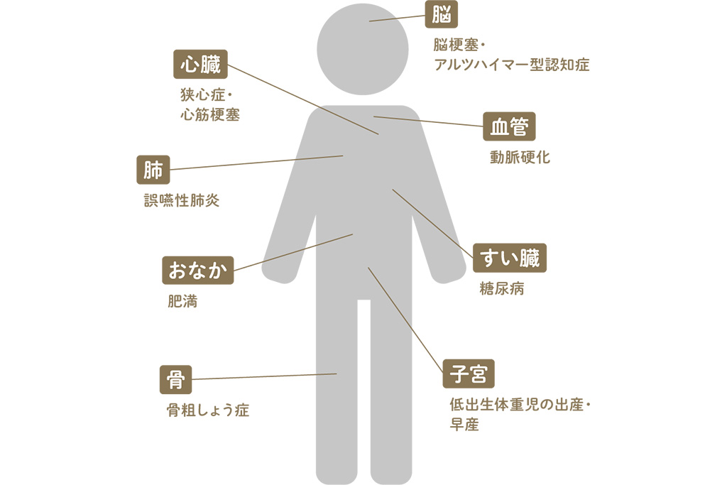 なぜ、むし歯や歯周病を予防したほうがいいの？